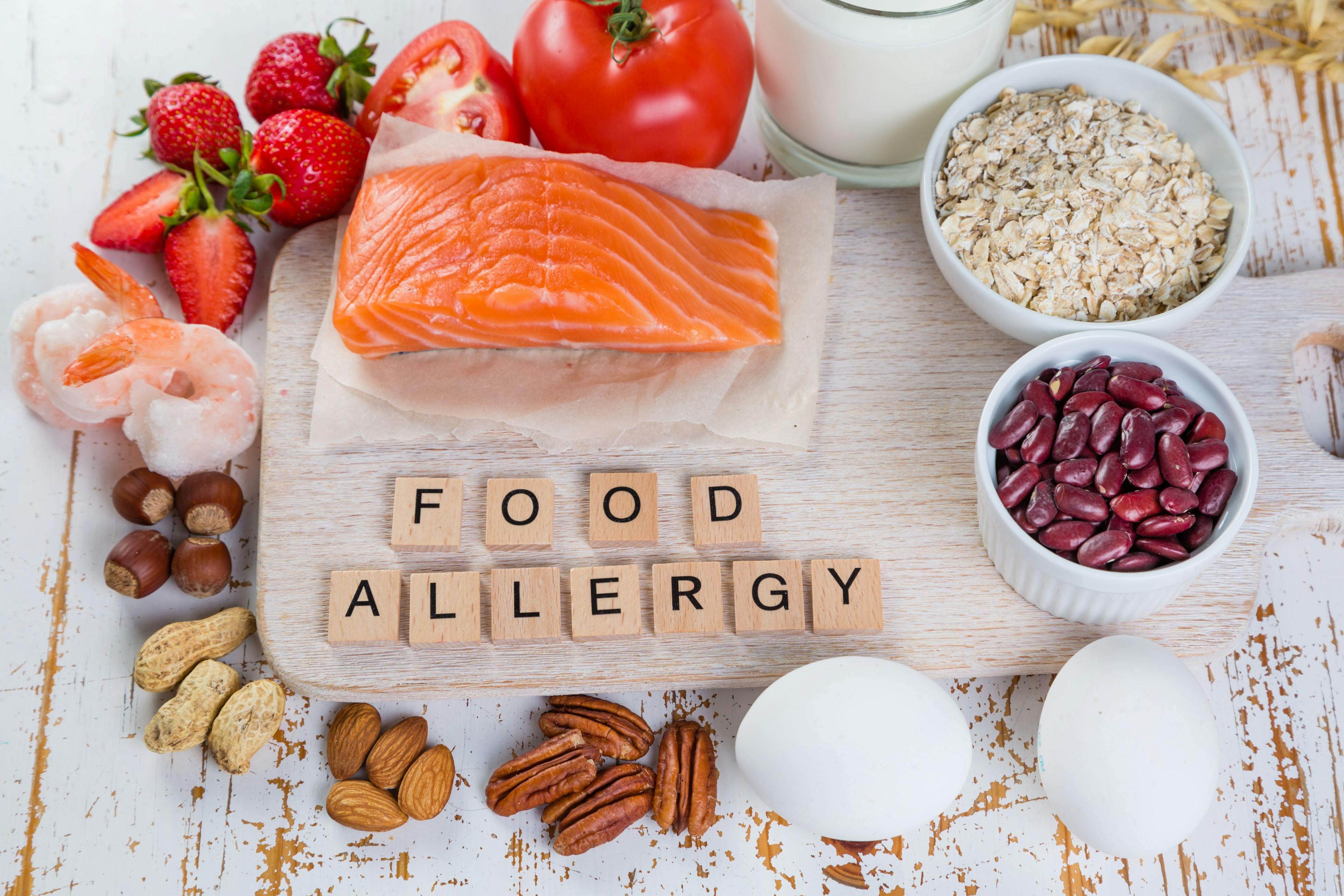 Quiz: Understanding Food Allergies
