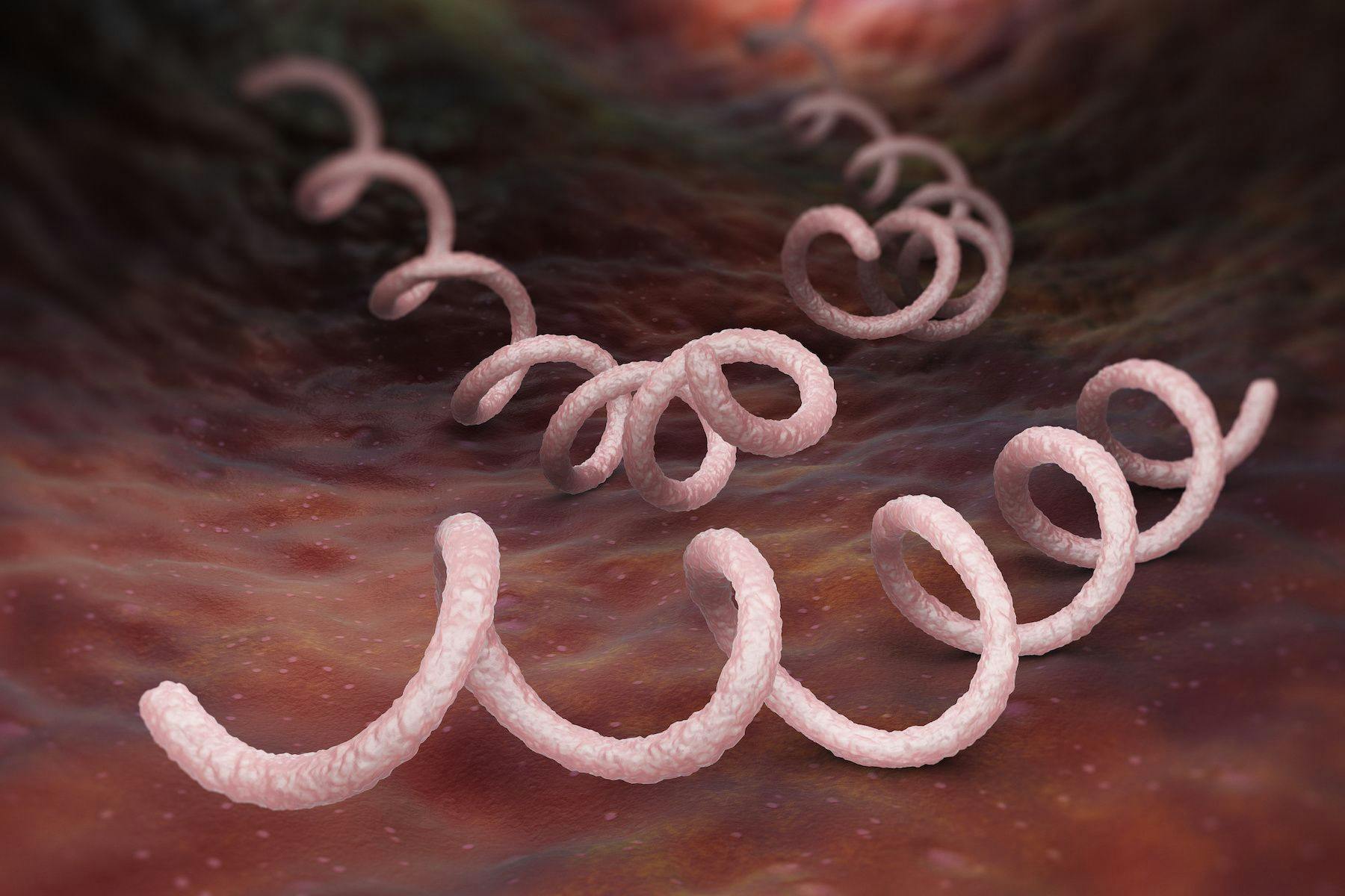 Congenital Syphilis Spike in Colorado Leads to Government Action