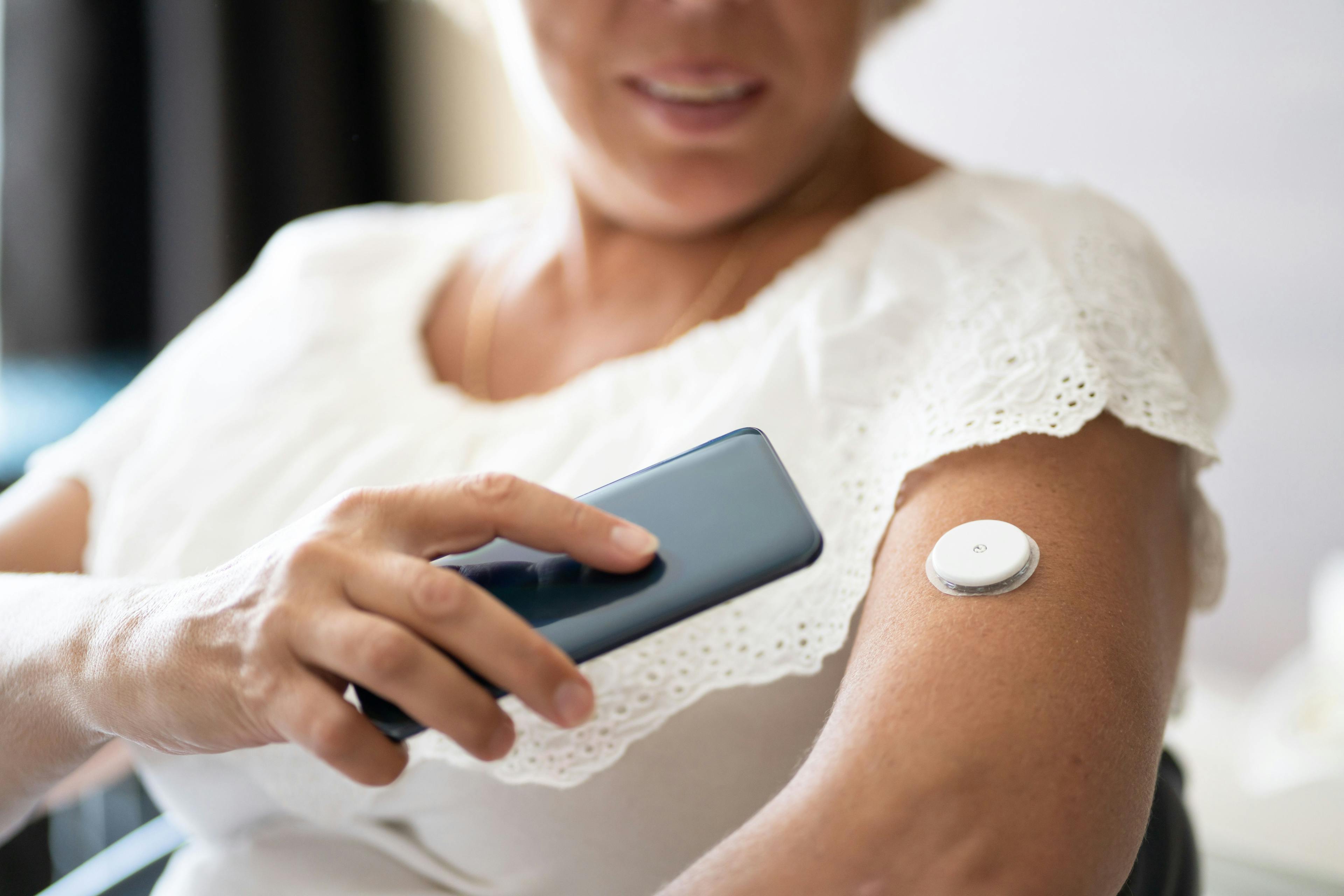 Woman testing glucose level with continuous glucose monitor / Andrey Popov - stock.adobe.com