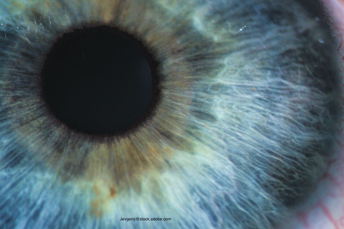 Digging into the Cause of Ocular Infections