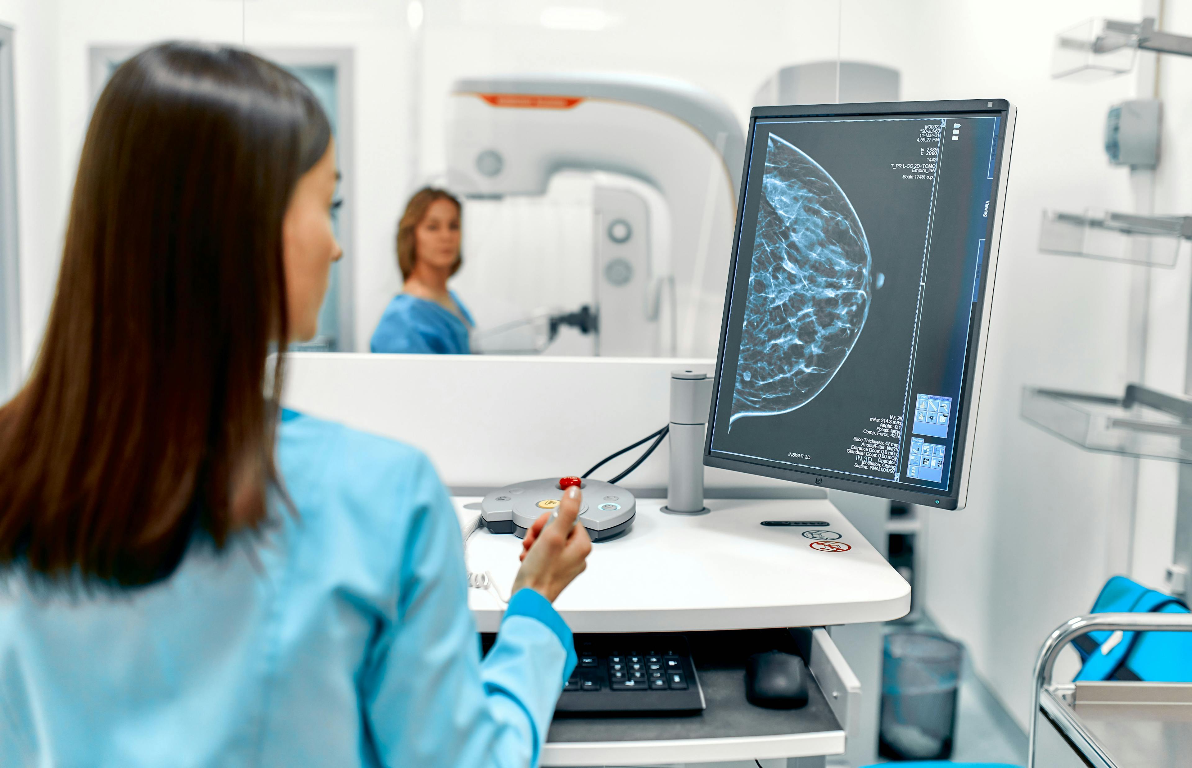Study Links False-Positive Mammography Result to Increased Breast Cancer Risk