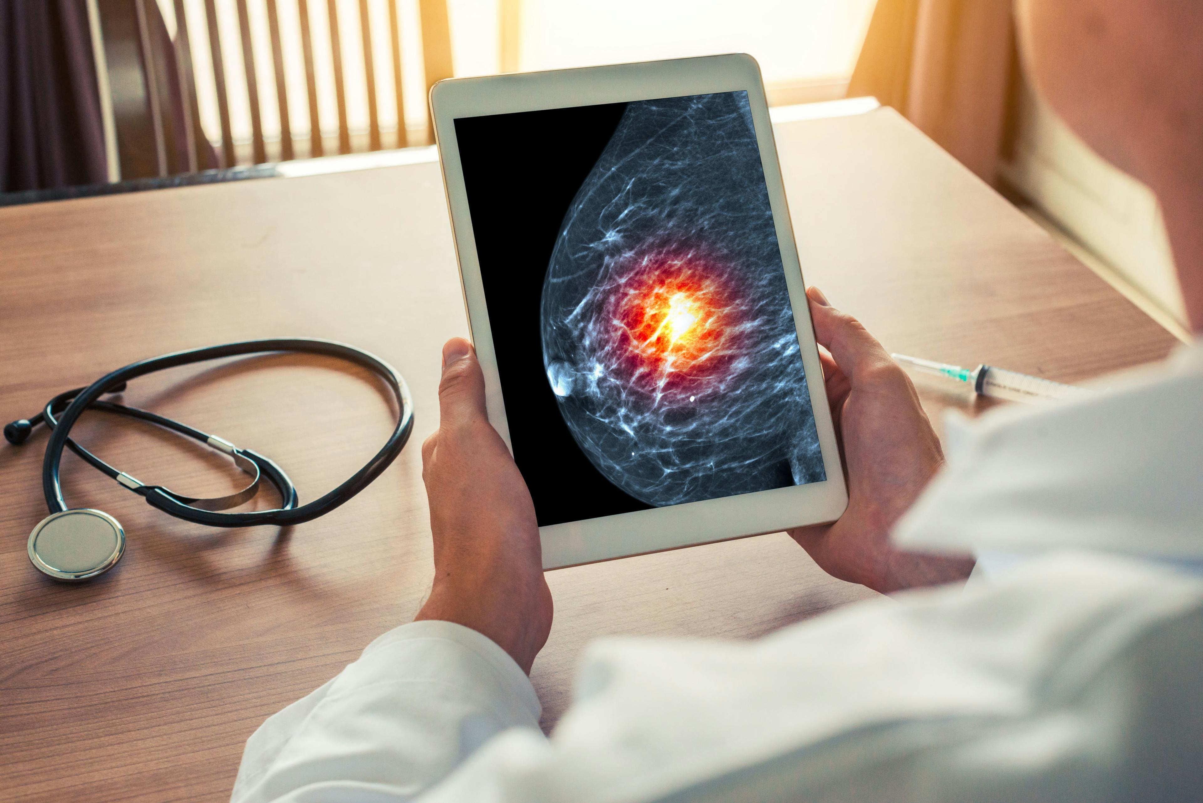 Doctor holding a digital tablet with x-ray mammogram / Steph Photographies - stock.adobe.com