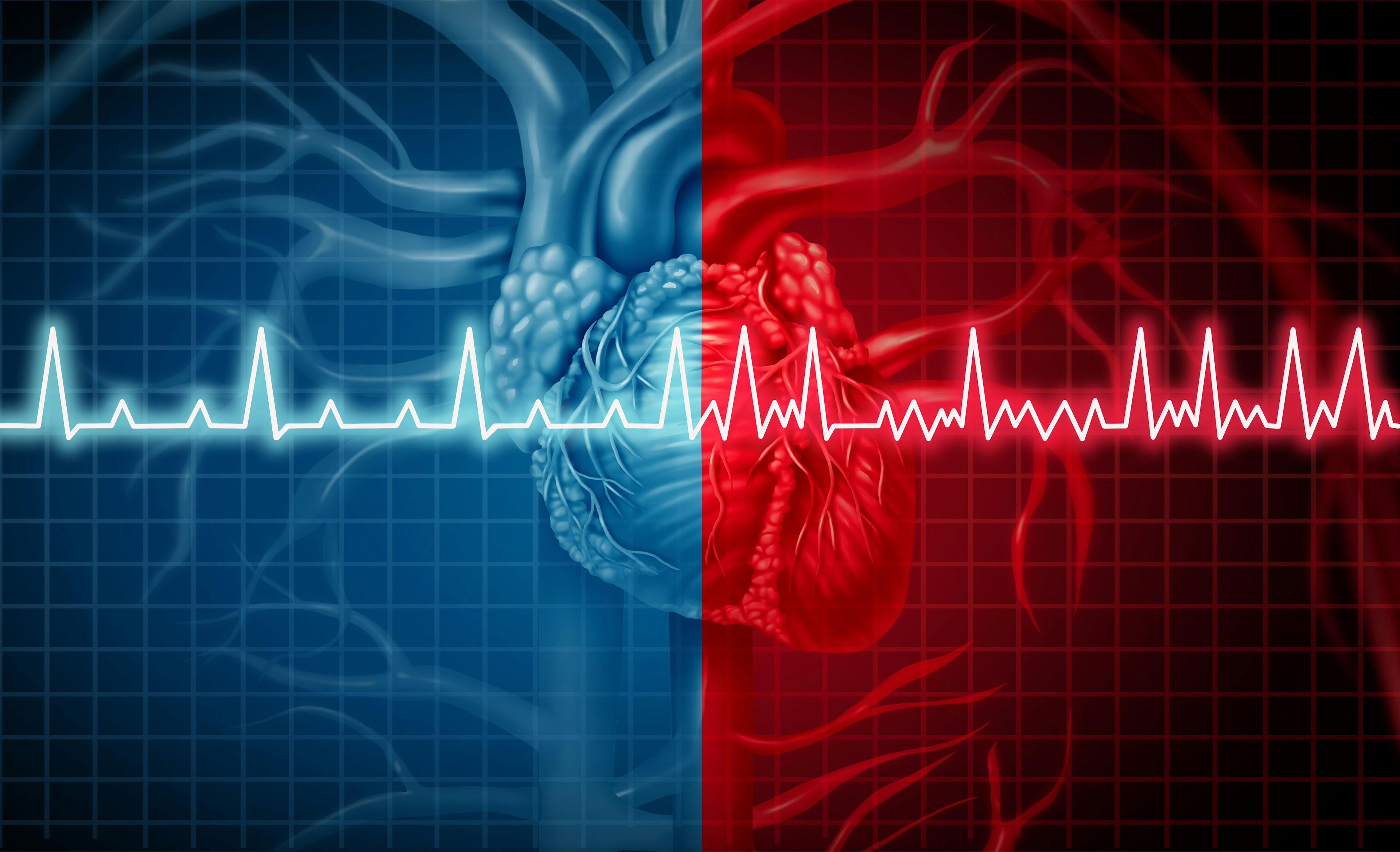 Atrial fibrillation is the most common type of irregular heartbeat. | image credit: freshidea - stock.adobe.com