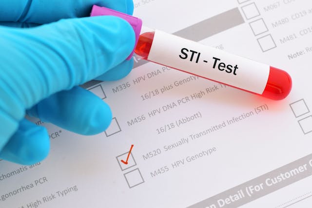 Increase in STIs Among Adolescents Witnessed During COVID-19 Pandemic