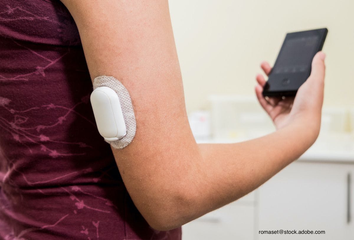 Continuous Glucose Monitoring and Its Part in Diabetes Management