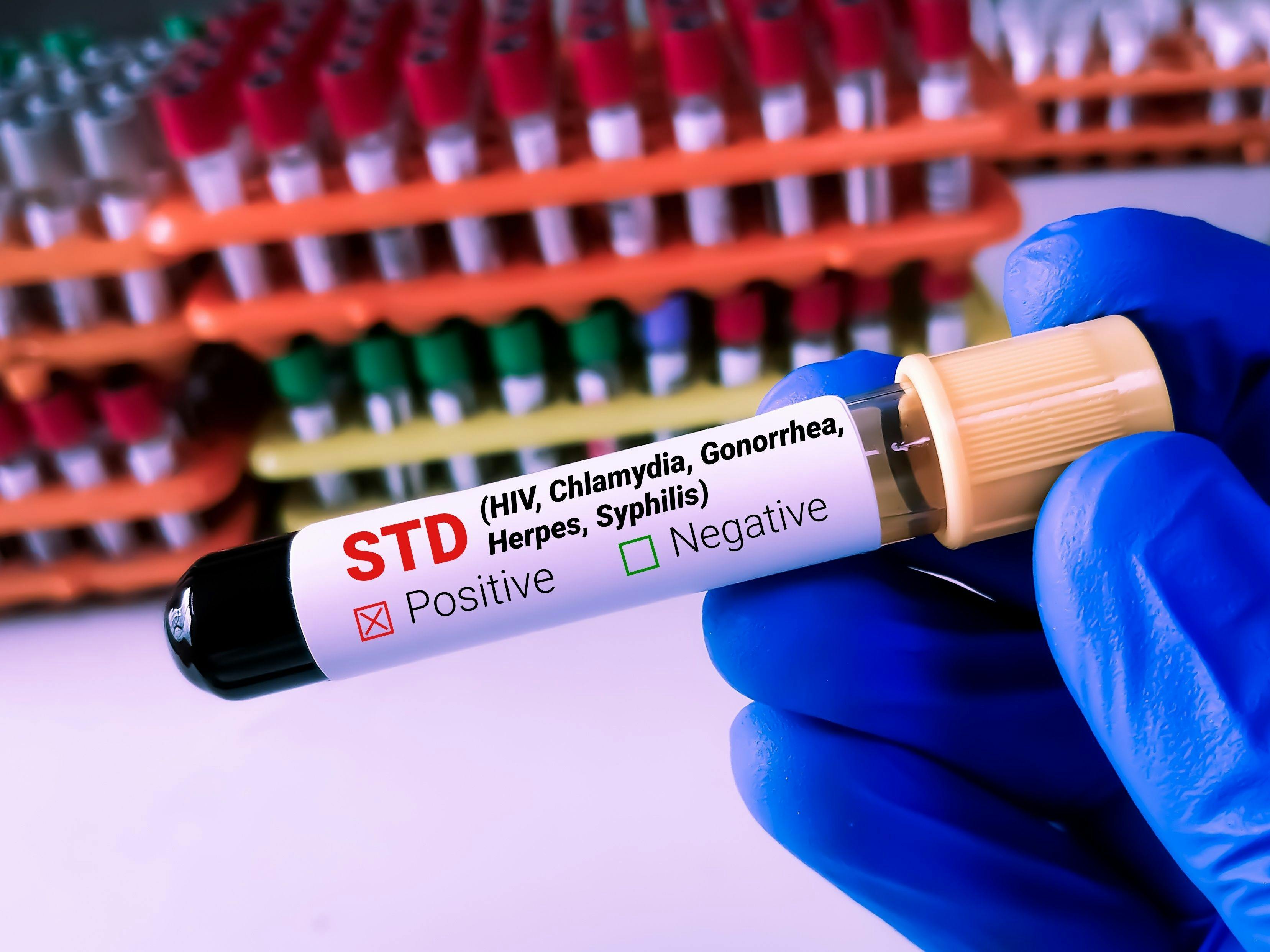 Rethinking STI Testing Through Partnerships Between Community Pharmacy and Public Health 