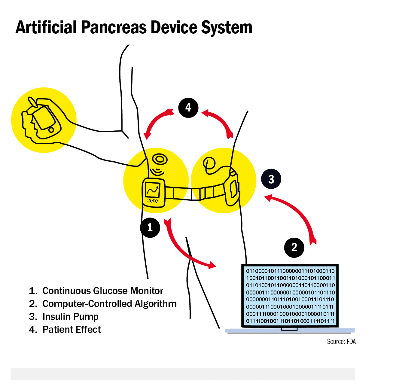 Artificial Pancreas Device System