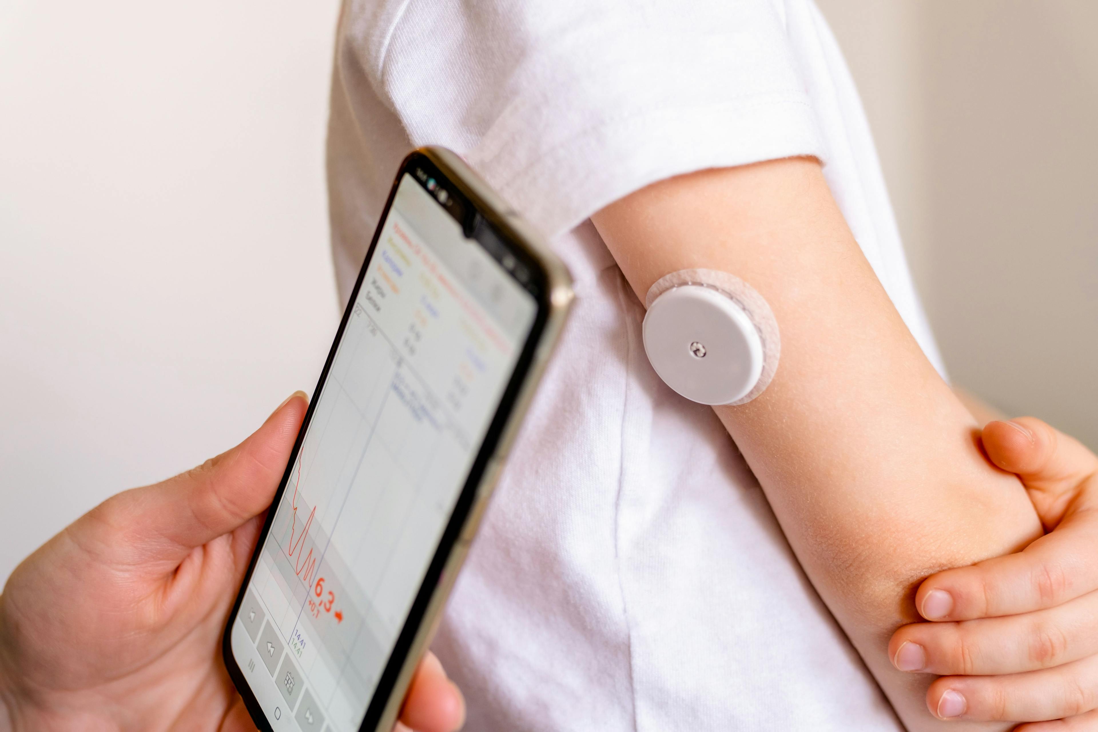 Type 1 Diabetes Management Could Improve With Use of Do-It-Yourself CGM