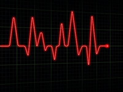 Lower Socioeconomic Status Increases Risk of Hospitalization, Death With Antiarrhythmic Drugs