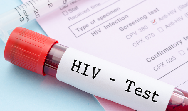 HIV test in blood vial