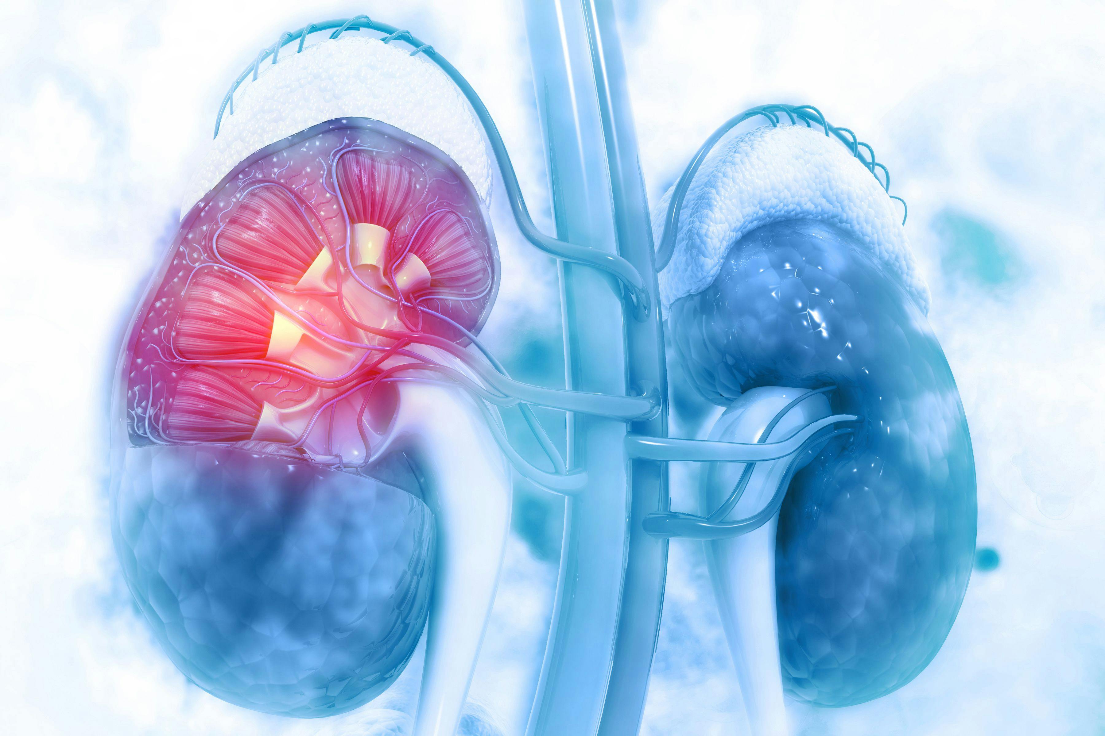 Managing Chronic Kidney Disease in Patients With Diabetes