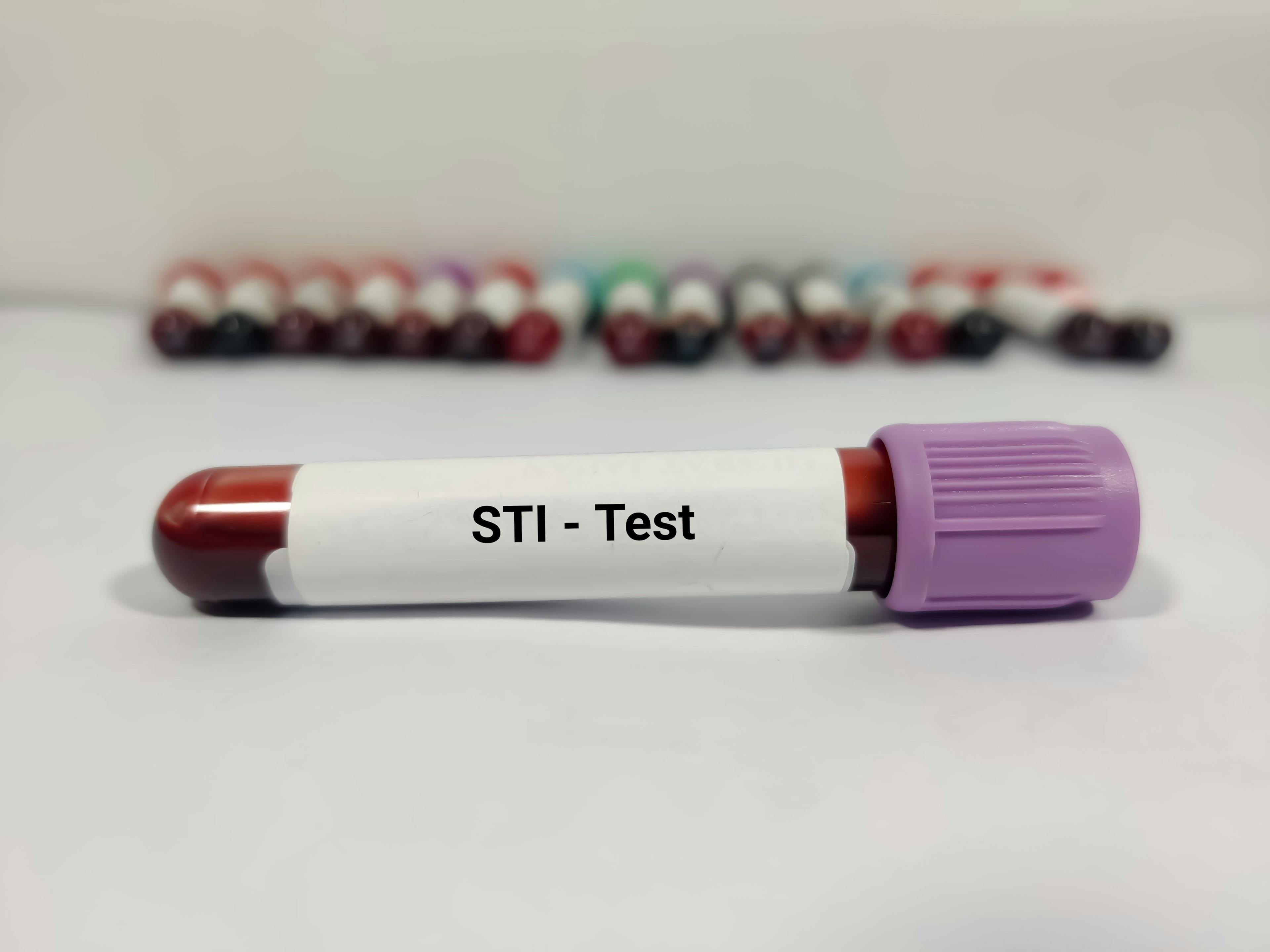 STI test | Image Credit: Innovative Creation - stock.adobe.com