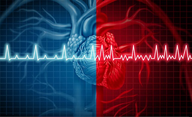 American Heart Association Launches Initiative to Include Pharmacists in Atrial Fibrillation Care