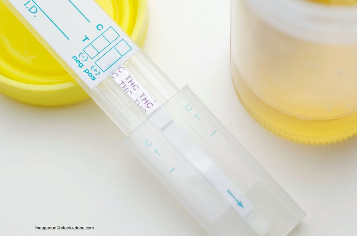 Drug Testing Challenges Emerge With CBD Product Use