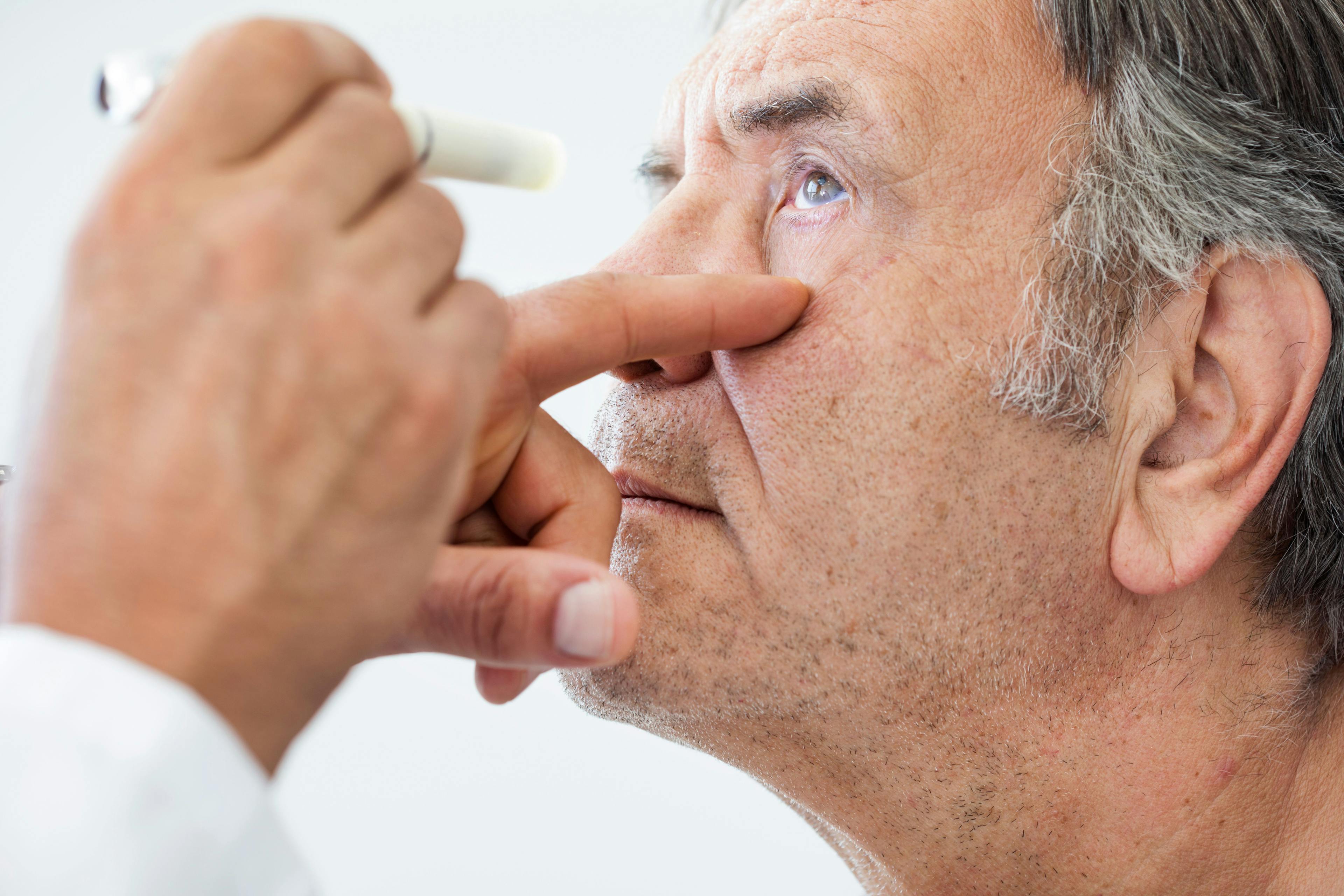 Diabetes-Related Eye Disease Remains High In United States