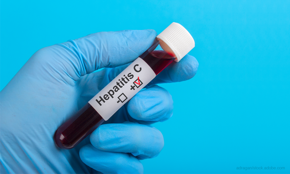 Hepatitis C blood test