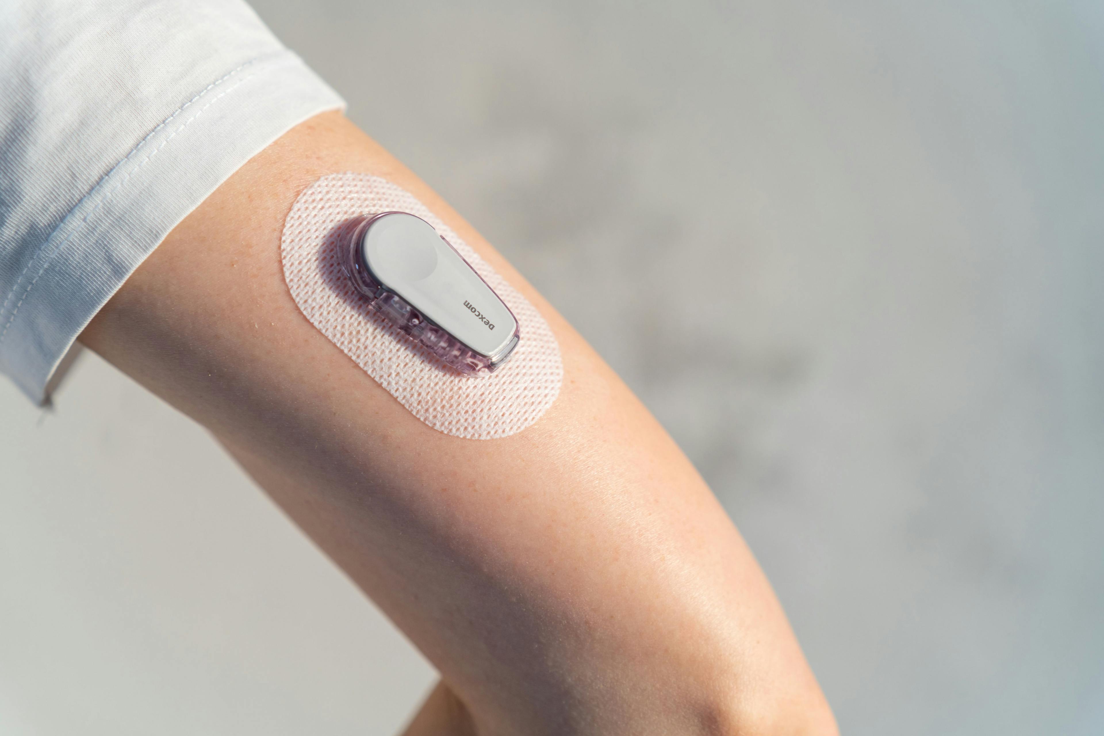 Initiation of Continuous Glucose Monitoring Reduced Hospitalizations for Diabetes, CKD 