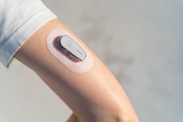 Initiation of Continuous Glucose Monitoring Reduced Hospitalizations for Diabetes, CKD 