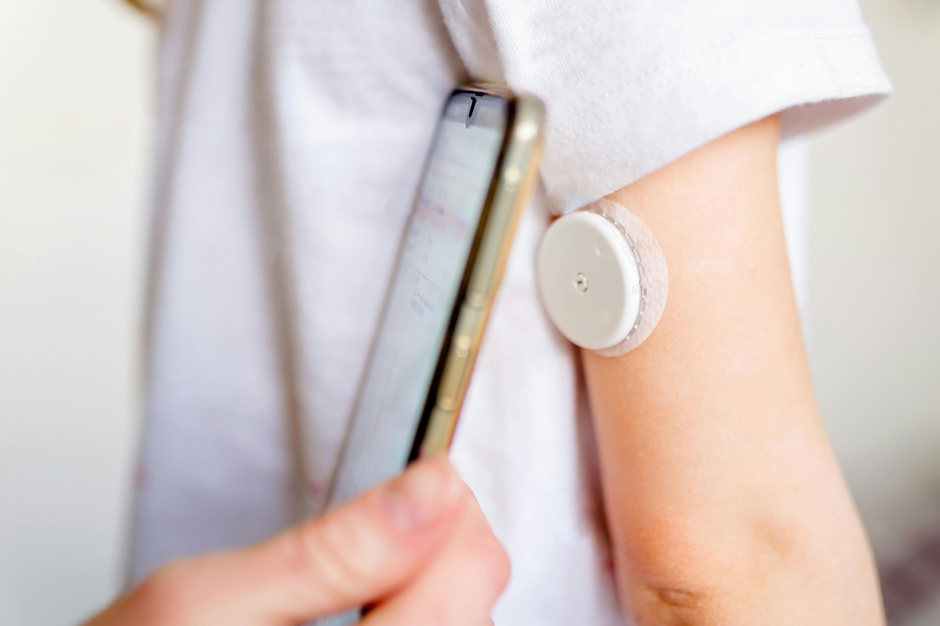 CGM Technology Bridges the Gap in Type 2 Diabetes Care for Underserved Patients