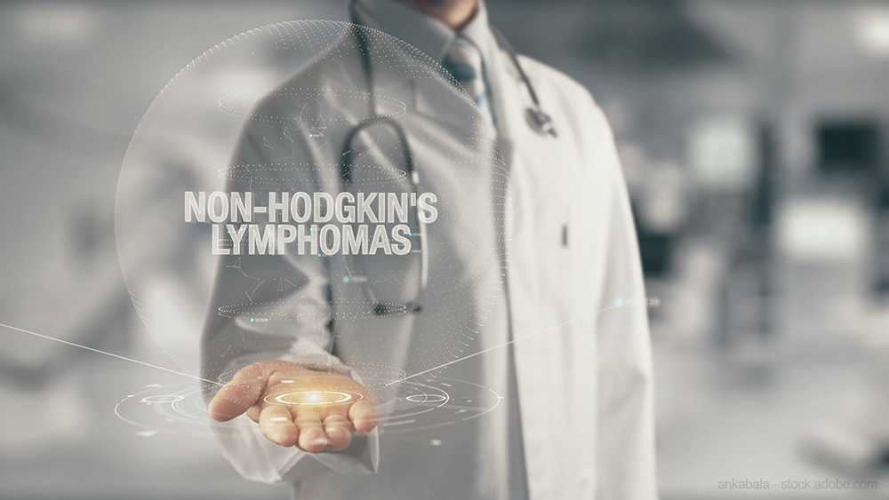 Non-Hodkin's Lymphoma